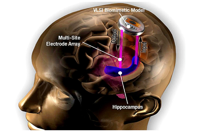 Nöral İmplantlar: Geleceğin Elektrikle Çalışan Beyinleri