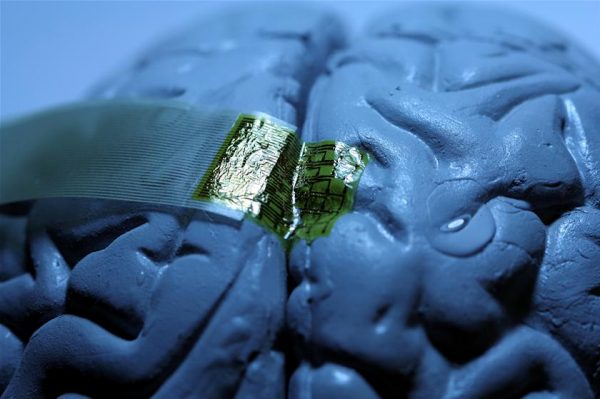 Sibernetik İmplantlar Beyin Hasarını Onarabiliyor