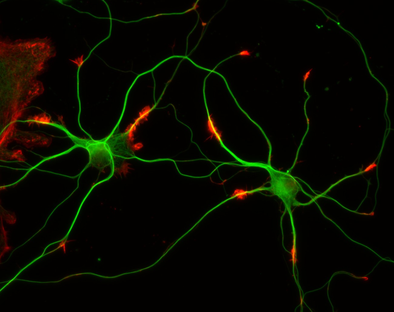 Hastalıklar Nöron Transfer Ederek Tedavi Edilebilir