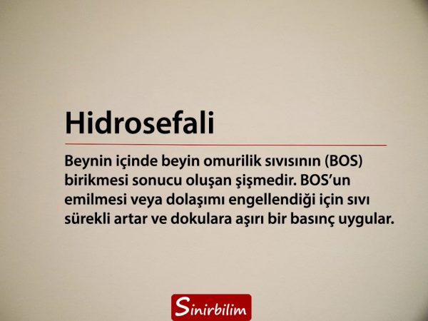Hidrosefali
