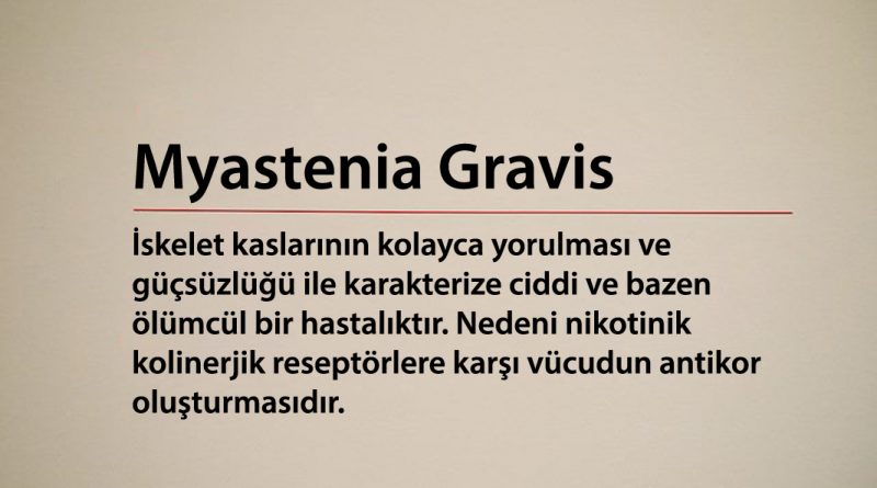 Miyasteniya Gravis