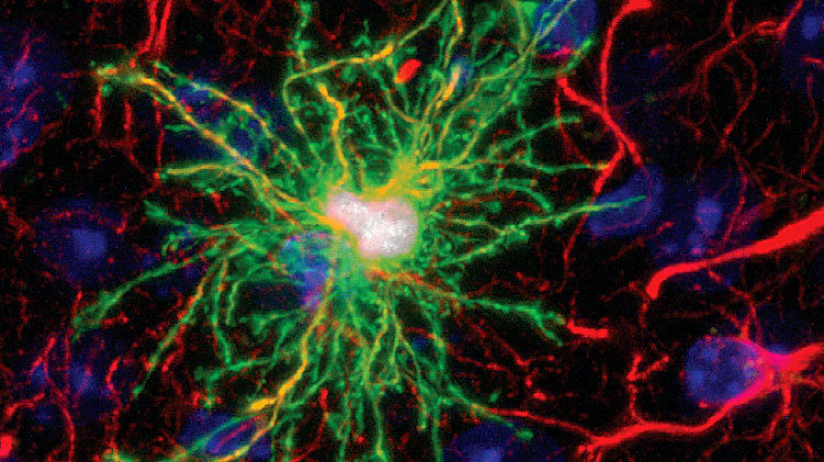 Glia Hücreleri Nöronların Şeklini Değiştirebiliyor