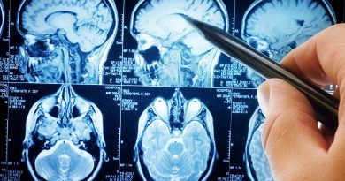 Travmatik Beyin Hasarı Yüzlerce Geni Değiştirebilir