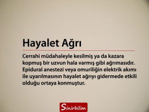 Hayalet Ağrı