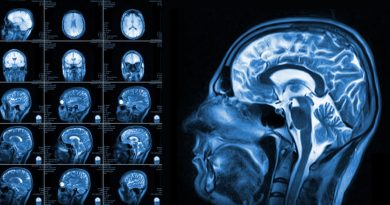 Beyin Taramaları Gelecekten Haber Verebilir