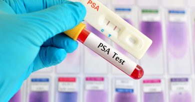 Prostat Kanseri Taramasında PSA Testi Ne Kadar Etkili Oluyor?
