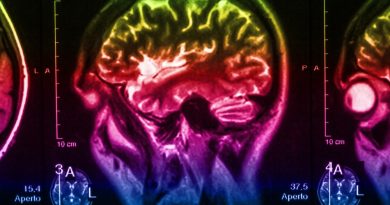 Parkinson Hastalığı'nın Erken Belirteci: Serotonin
