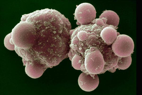 Apoptoz: Programlı Hücre Ölümü Nedir?