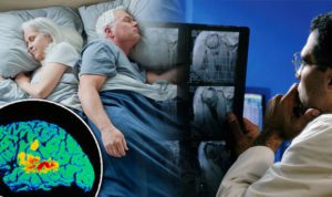Alzheimer Hastalığı ile Uyku Düzeni Arasında Bir Bağlantı Bulundu