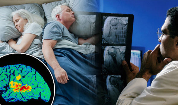 Alzheimer Hastalığı ile Uyku Düzeni Arasında Bir Bağlantı Bulundu